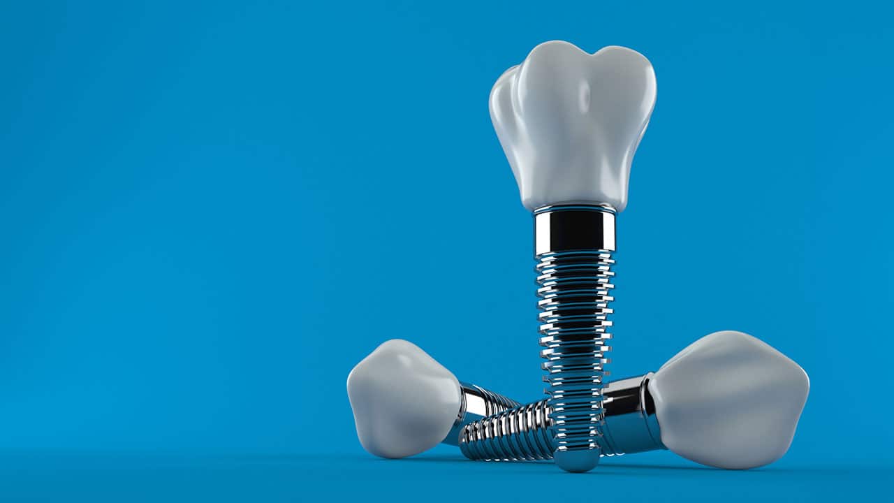 Discover the Latest Innovations and Success Rates in Short Dental