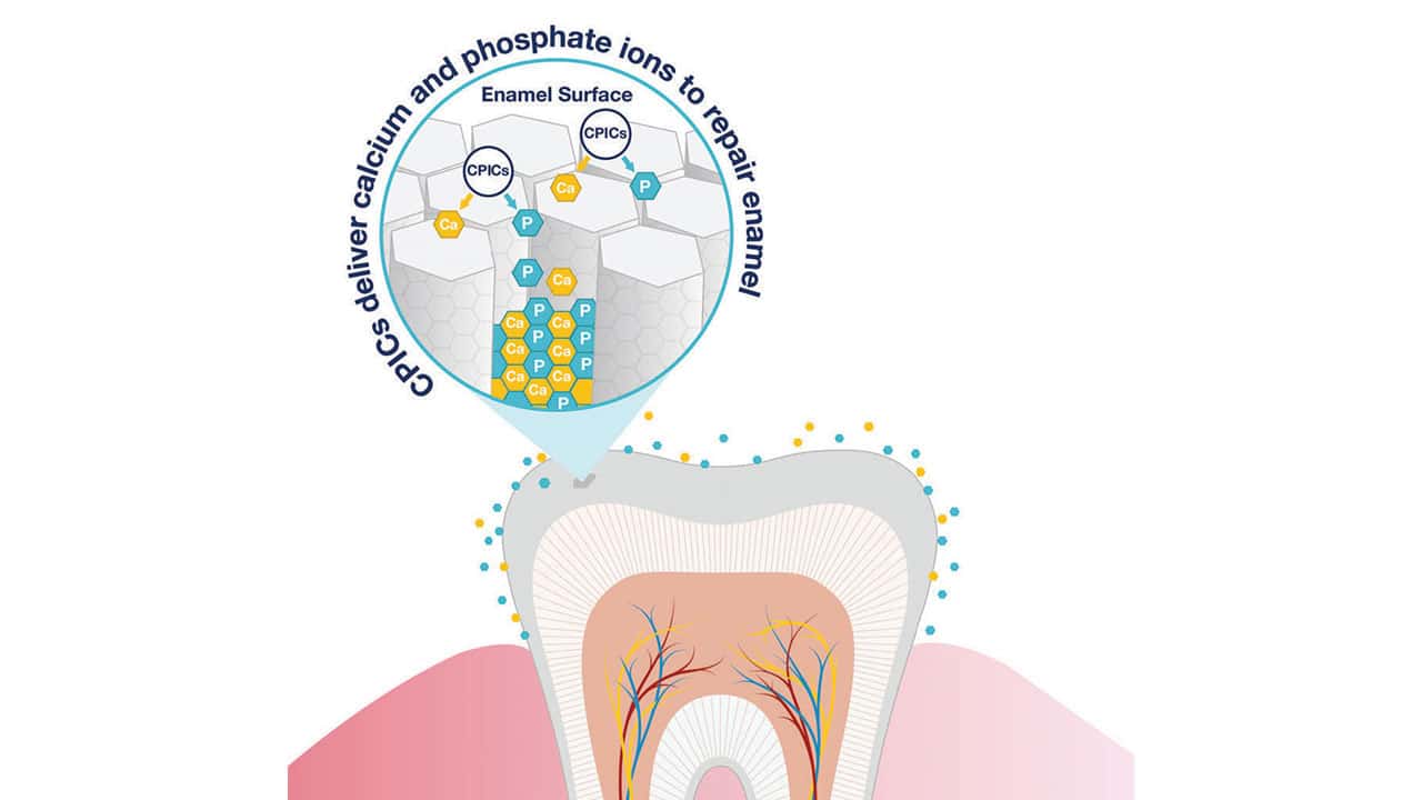 Enamel Modification An Innovative Approach to Enamel Regeneration - Dimensions of Dental ...