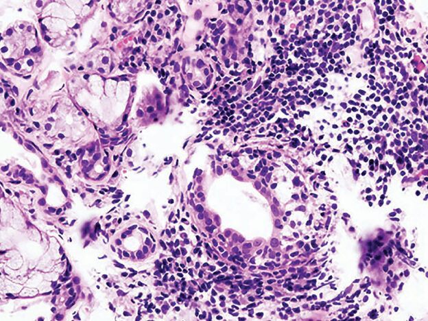 Managing Sjögren Syndrome course image