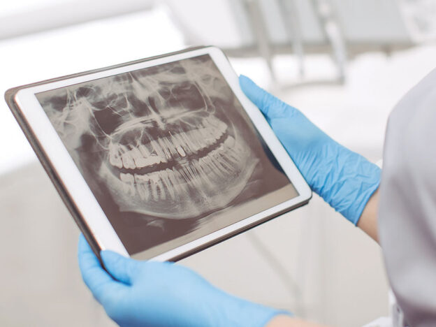 Tips for Identifying Systemic Conditions and Anomalies on the Panoramic Image course image