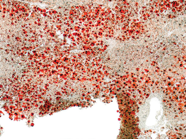 The Hidden Oral-Liver Connection course image