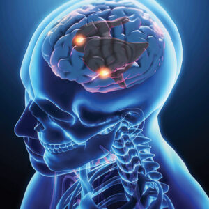 Recognizing and Responding to Young-Onset Dementia