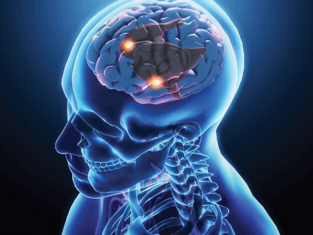 Recognizing and Responding to Young-Onset Dementia course image