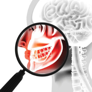 Navigating Dental Care for Patients With Ehlers–Danlos Syndromes