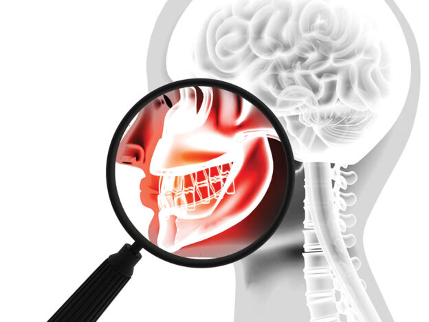 Navigating Dental Care for Patients With Ehlers–Danlos Syndromes course image