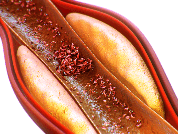 Sickle Cell Disease in the Dental Chair course image