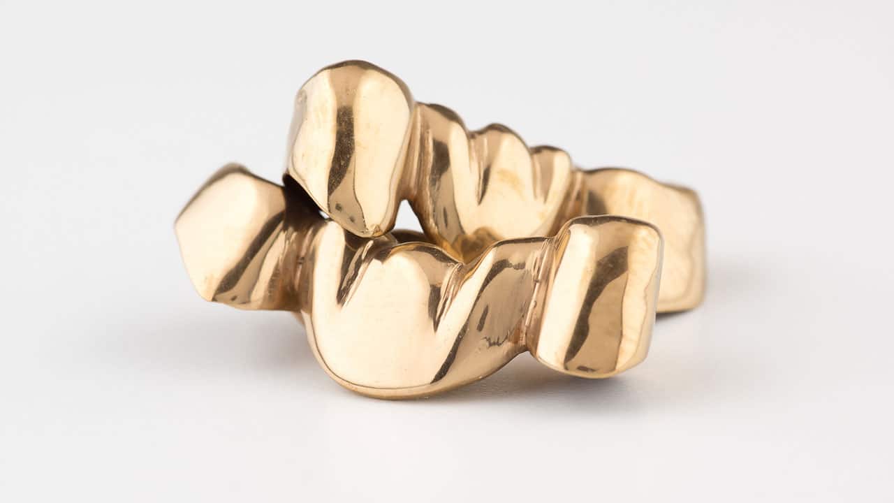 A Medieval Gold Bridge Reveals the Surprising Origins of Cosmetic Dentistry