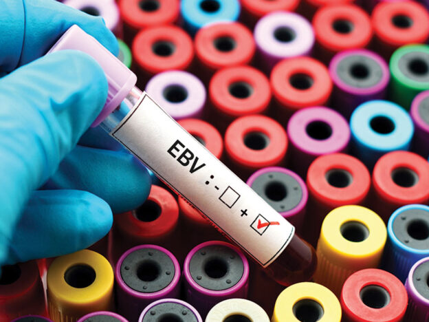 How the Epstein-Barr Virus Impacts Periodontal Health course image