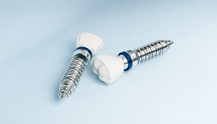 Two titanium dental implants with ceramic crowns on a pale blue background