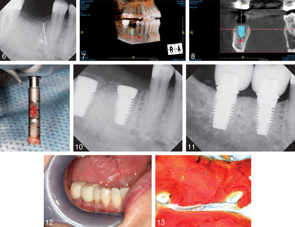 Nevi Group Nevi Group