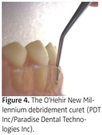 All About Hand Instruments Dimensions Of Dental Hygiene