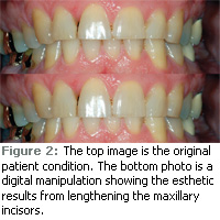 Digital Dental Imaging - Dimensions of Dental Hygiene