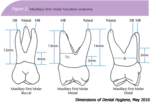 Furcation Anatomy Dimensions Of Dental Hygiene Furcation Anatomy Dimensions Of Dental Hygiene