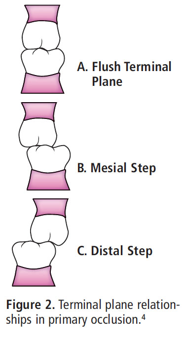 Managing the Developing Occlusion - Dimensions of Dental Hygiene