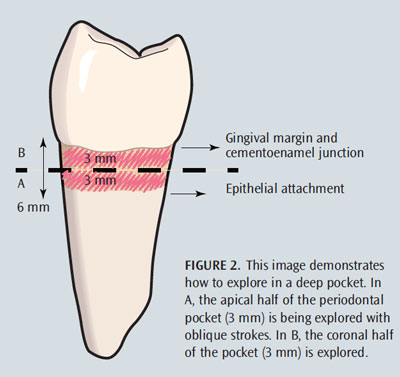 A Close Up Look At Explorers Dimensions Of Dental Hygiene