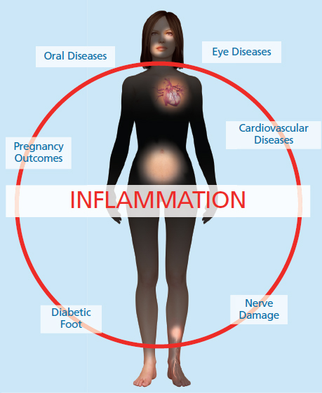 Periodontal inflammation