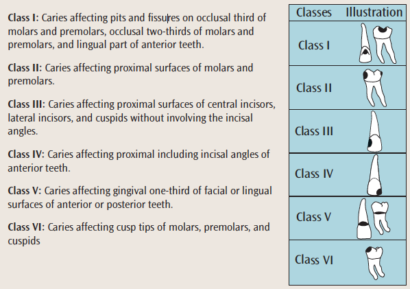 Caries Classification - Dimensions of Dental Hygiene